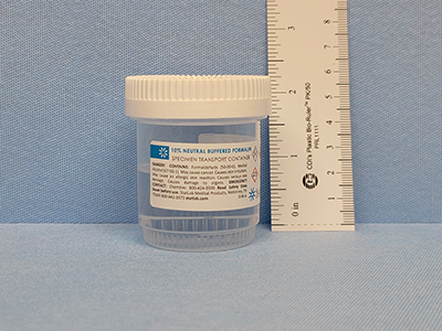 Prefilled 60 ML